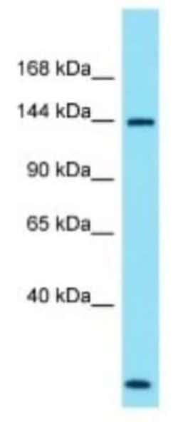 SPATA31A1 Rabbit anti-Human, Polyclonal, Novus Biologicals 100 &mu;g | Buy Online | Novus Biologicals | Fisher Scientific